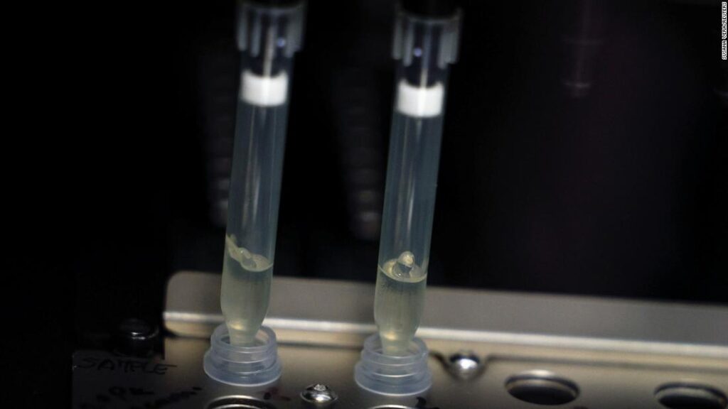 First monkeypox-related loss of life in Europe reported in Spain