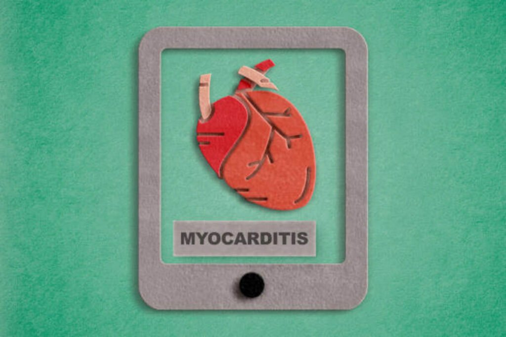 Myocarditis Treatment