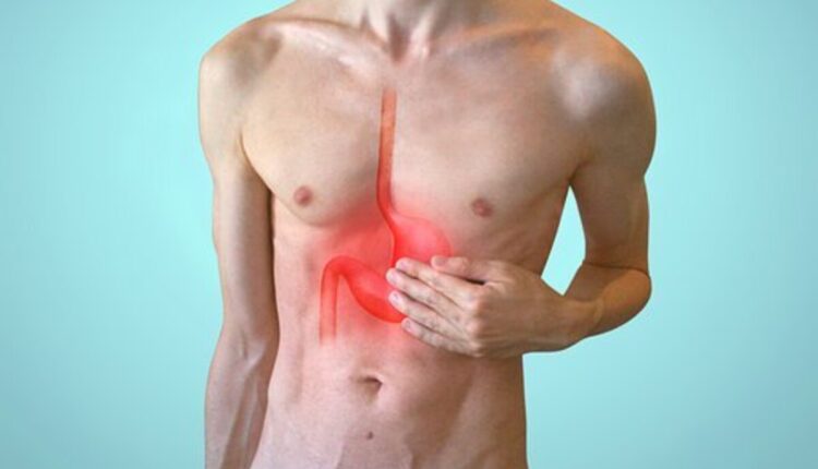 acid reflux symptoms