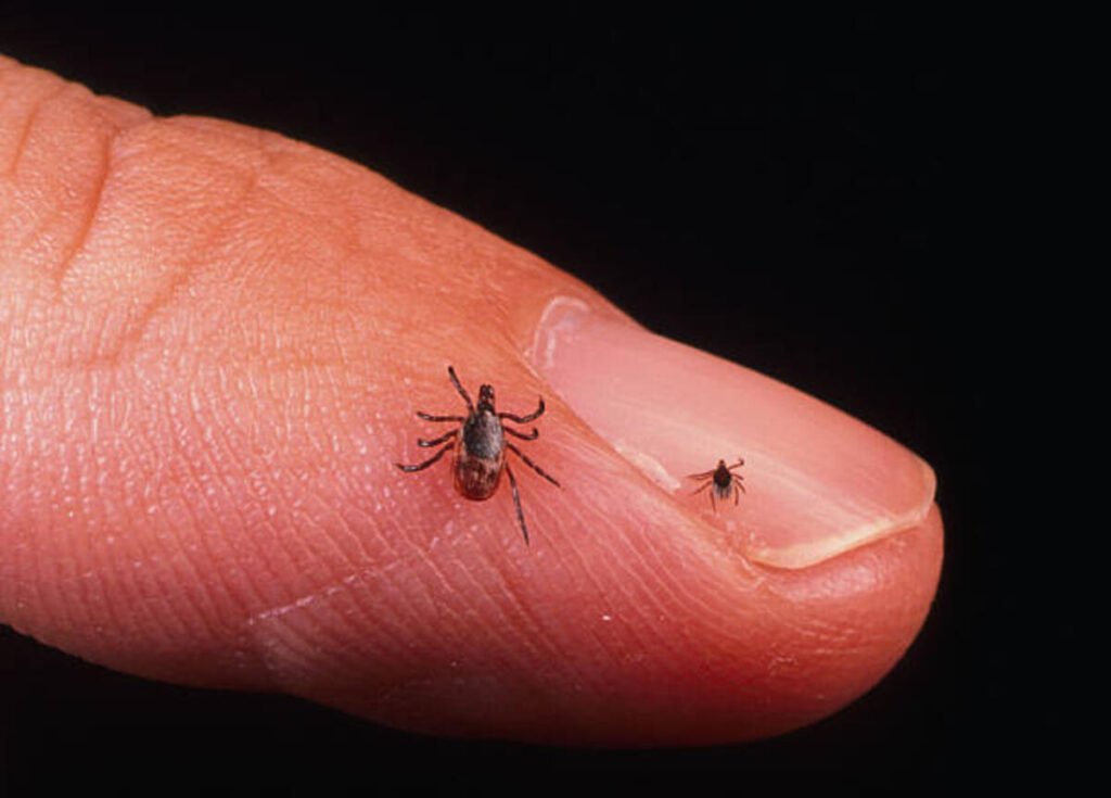 Symptoms of Lyme Disease