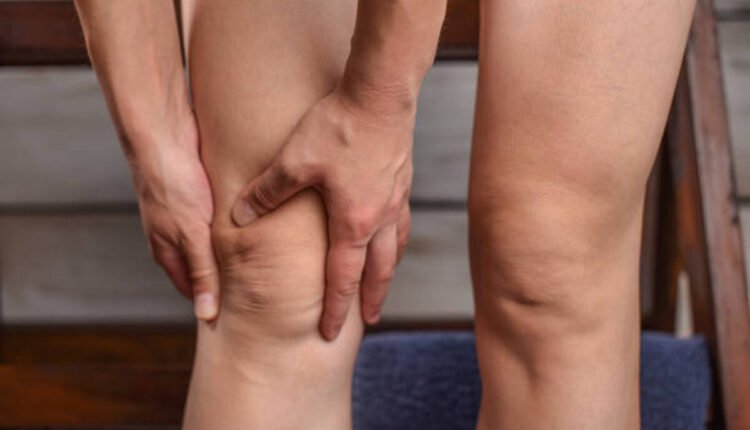 swelling