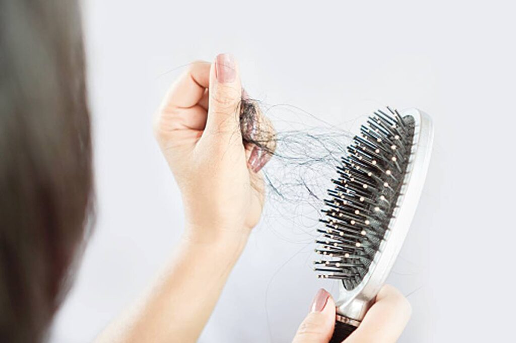 How you can Cure Thyroid Hair Loss – People With Hypothyroidism