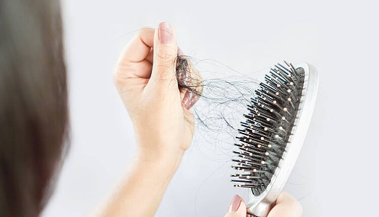 How To Cure Thyroid Hair Loss