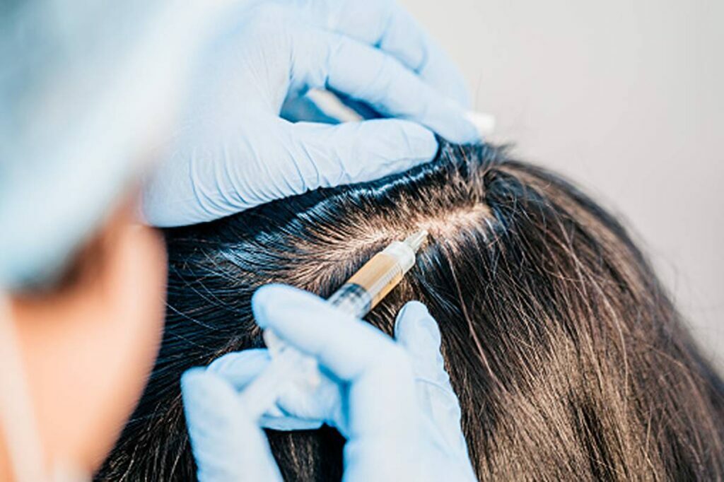 The key World of the Non-Medical Hair System and How to Leave your It!