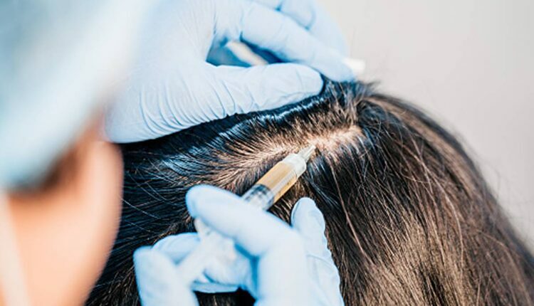 Non Surgical Hair System