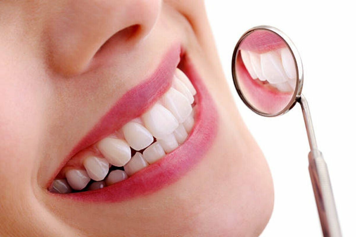 Aspen Dental Dentures Reviews
