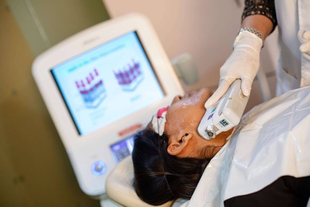 How Much Is Laser Hair Removal?