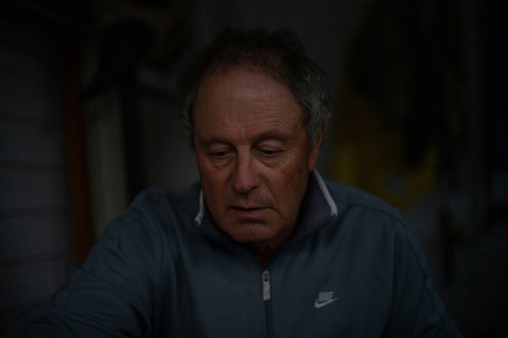How Much Is a Hair Transplant in Turkey?